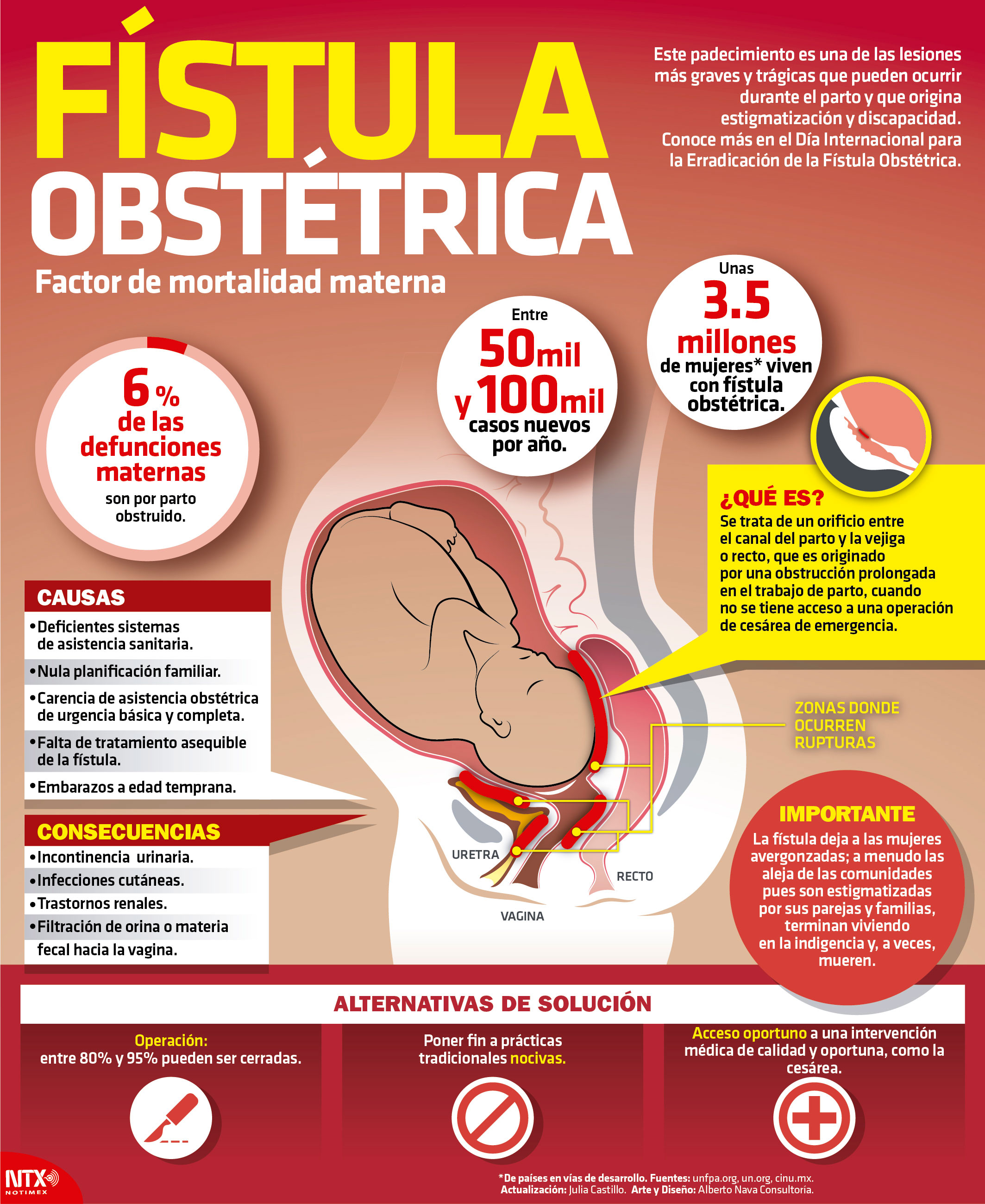 Fstula Obsttrica, factor de mortalidad materna 