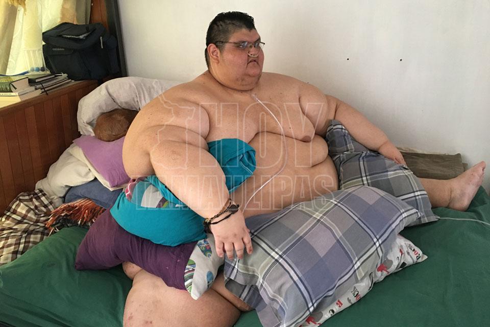 El hombre ms obeso del mundo
