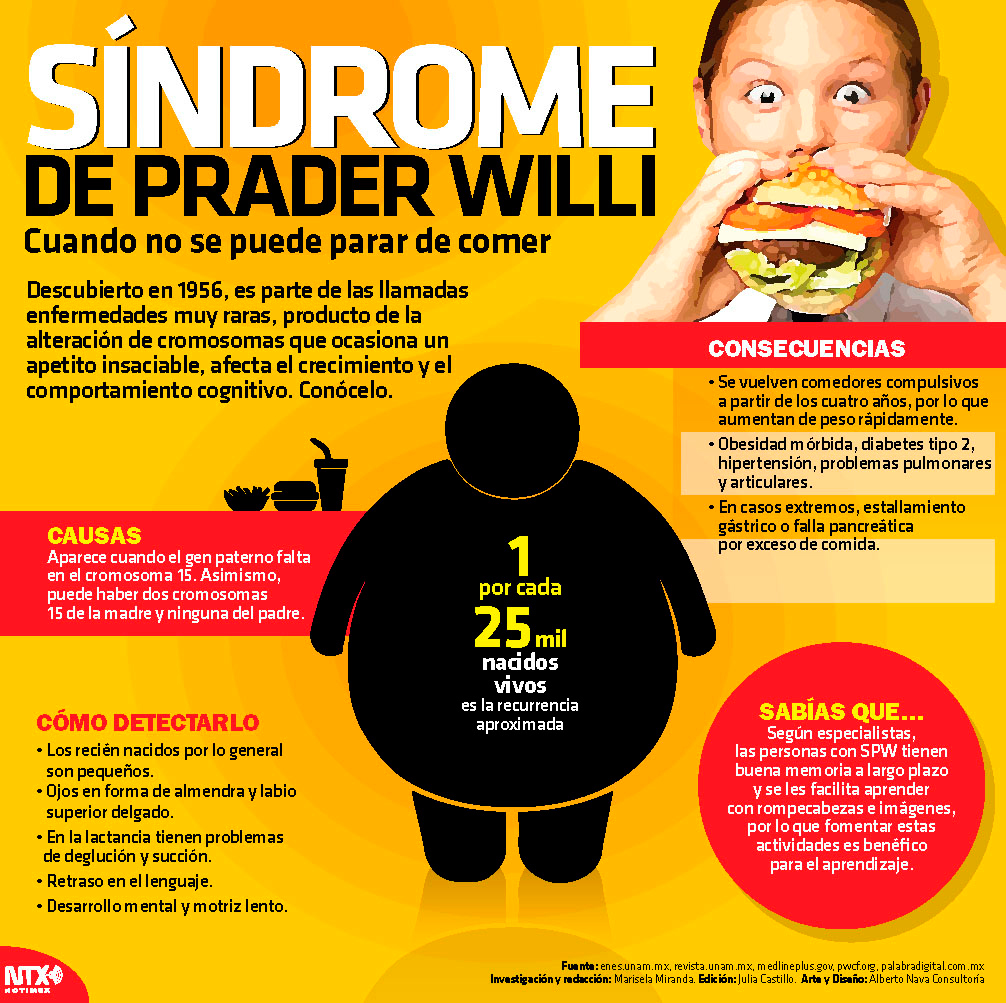 S�ndrome de Prader Willi