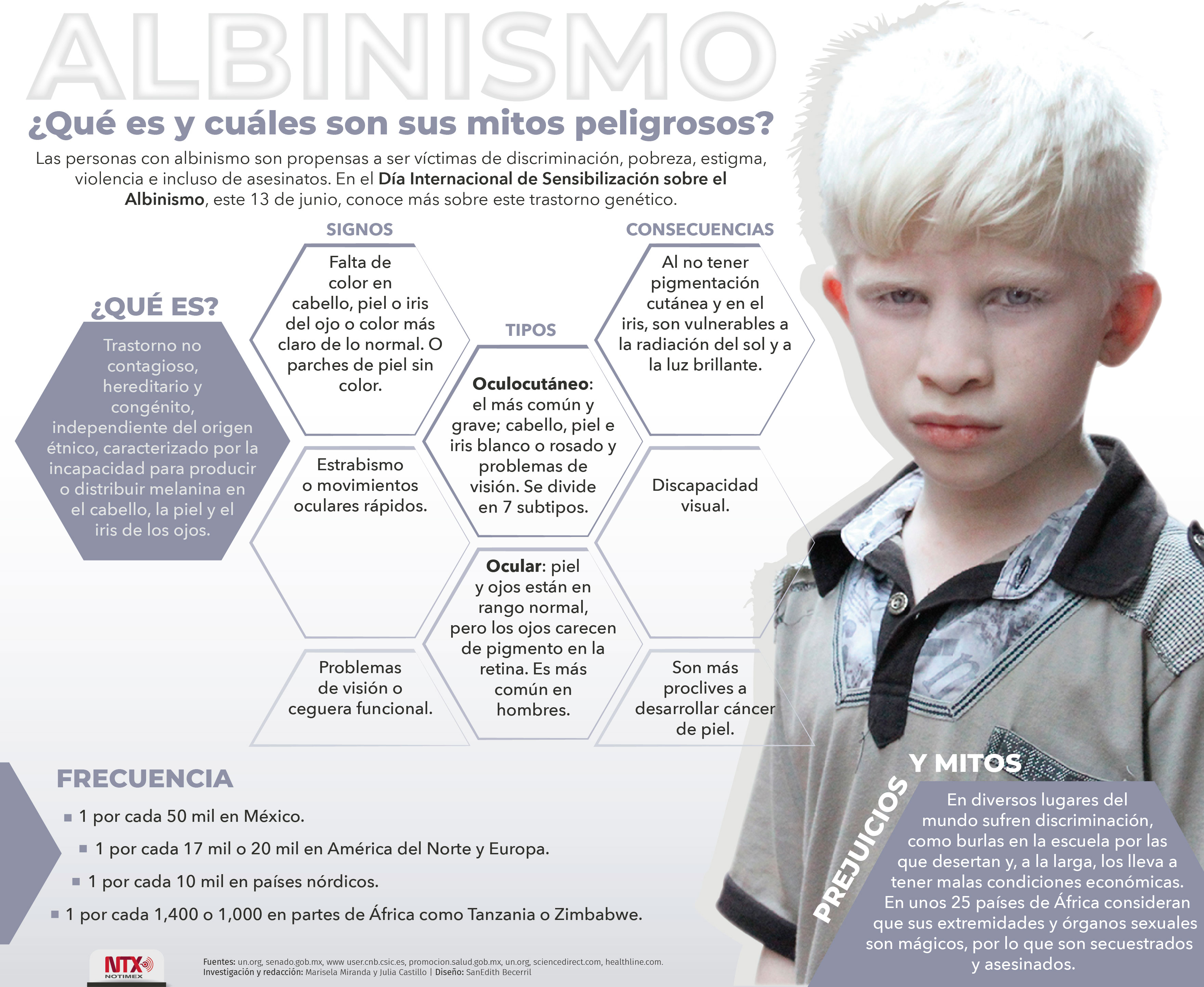 Albinismo
