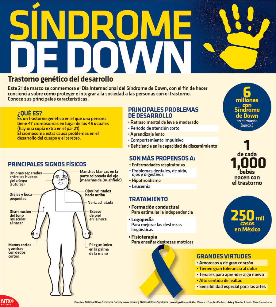 Síndrome de Down: trastorno genético del desarrollo
